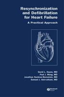 Resynchronization and Defibrillation for Heart Failure