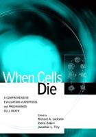 When Cells Die