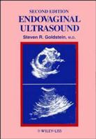 Endovaginal Ultrasound