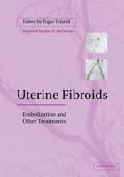 Uterine Fibroids: Embolization and Other Treatments