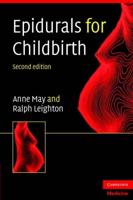 Epidurals for Childbirth