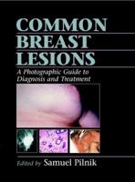 Common Breast Lesions
