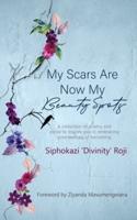 My Scars Are Now My Beauty Spots