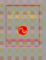 Color Atlas of Glaucoma