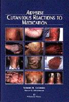 Adverse Cutaneous Reactions to Medication