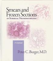 Smears & Frozen Sections in Surgical Neuropathology