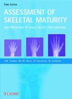 Assessment of Skeletal Maturity and Prediction of Adult Height (TW3 Method)