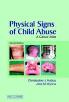 Physical Signs of Child Abuse