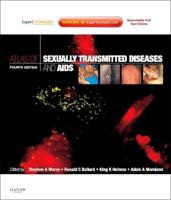 Atlas of Sexually Transmitted Diseases and AIDS