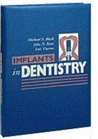 Implants in Dentistry