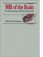 MRI of the Brain