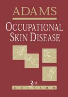 Occupational Skin Disease