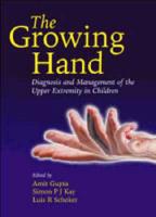 The Growing Hand