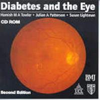 Diabetes and the Eye, CD-ROM