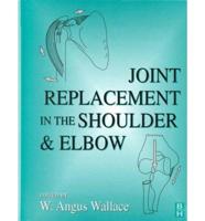 Joint Replacement in the Shoulder and Elbow