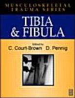 Tibia and Fibula