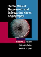 Stereo Atlas of Fluorescein and Indocyanine Green Angiography