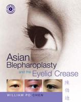 Asian Blepharoplasty and the Eyelid Crease