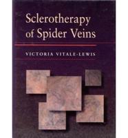 Sclerotherapy of Spider Veins