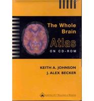 The Whole Brain Atlas CD-ROM