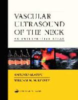 Vascular Ultrasound of the Neck