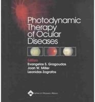 Photodynamic Therapy of Ocular Diseases