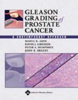 Gleason Grading of Prostate Cancer