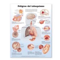 Dangers of Smoking Anatomical Chart in Spanish (Peligros Del Tabaquismo)