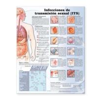 Sexually Transmitted Infections Anatomical Chart in Spanish (Infecciones De Transmisión Sexual)