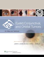 Eyelid, Conjunctival, and Orbital Tumors