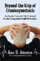 Beyond the Grip of Craniosynostosis: An Inside View of Life Touched by the Congenital Skull Deformity