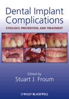 Dental Implant Complications