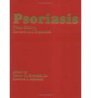 Psoriasis