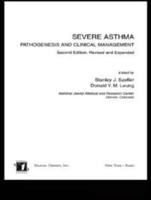 Severe Asthma : Pathogenesis and Clinical Management