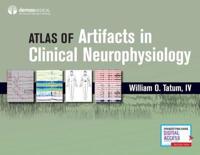 Atlas of Artifacts of Clinical Neurophysiology