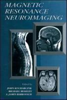 Magnetic Resonance Neuroimaging