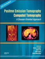 Positron Emission Tomography Computed Tomography
