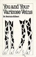 You and Your Varicose Veins