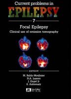 Focal Epilepsy