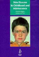 Skin Disease in Childhood and Adolescence