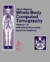 Whole Body Computed Tomography CD-ROM