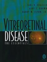 Vitreoretinal Disease