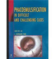Phacoemulsification in Difficult and Challenging Cases
