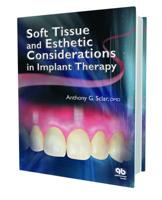 Soft Tissue and Esthetic Considerations in Implant Therapy