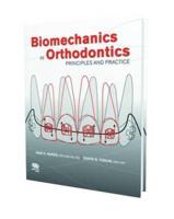 Biomechanics in Orthodontics