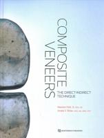 Composite Veneers