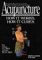 Acupuncture