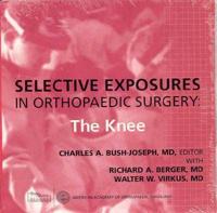 Selective Exposures in Orthopaedic Surgery: The Knee