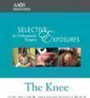 Selective Exposures in Orthopaedic Surgery