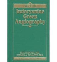 Atlas of Indocyanine Green Angiography